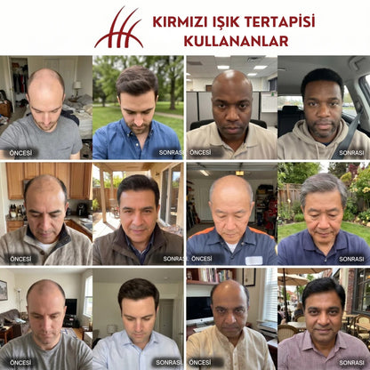 REDLIVE™ Kırmızı Işık Terapi Şapkası